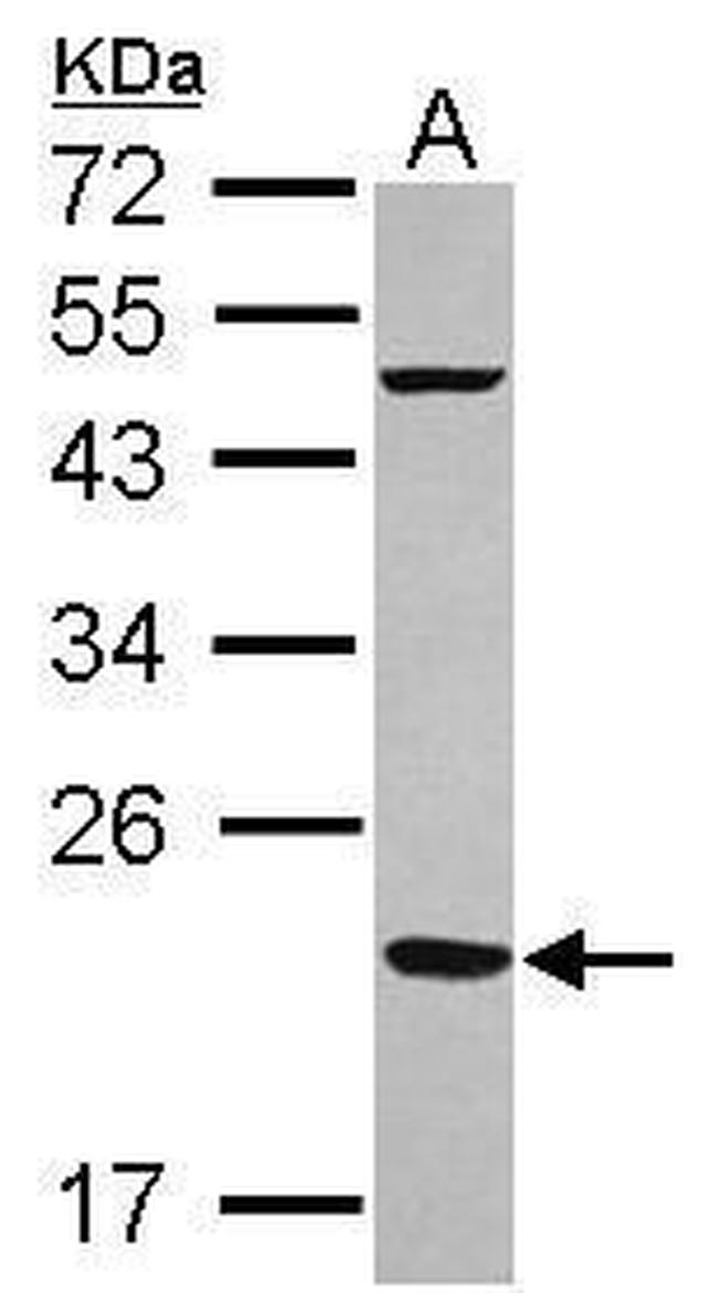 FTMT Antibody in Western Blot (WB)