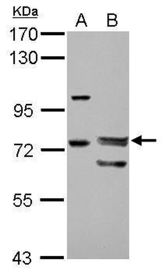 FOXP4 Antibody in Western Blot (WB)