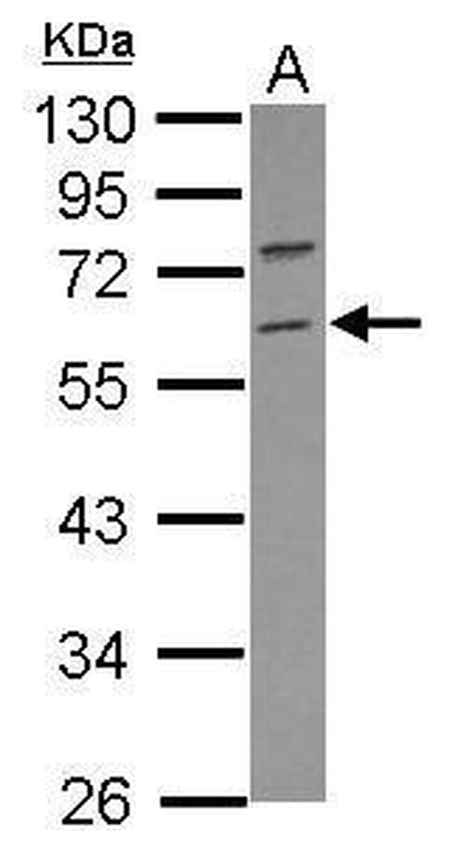 RNF36 Antibody in Western Blot (WB)