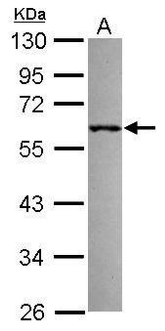 RNF36 Antibody in Western Blot (WB)