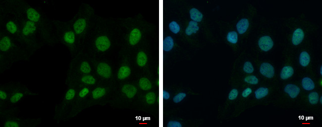 ZNF596 Antibody in Immunocytochemistry (ICC/IF)