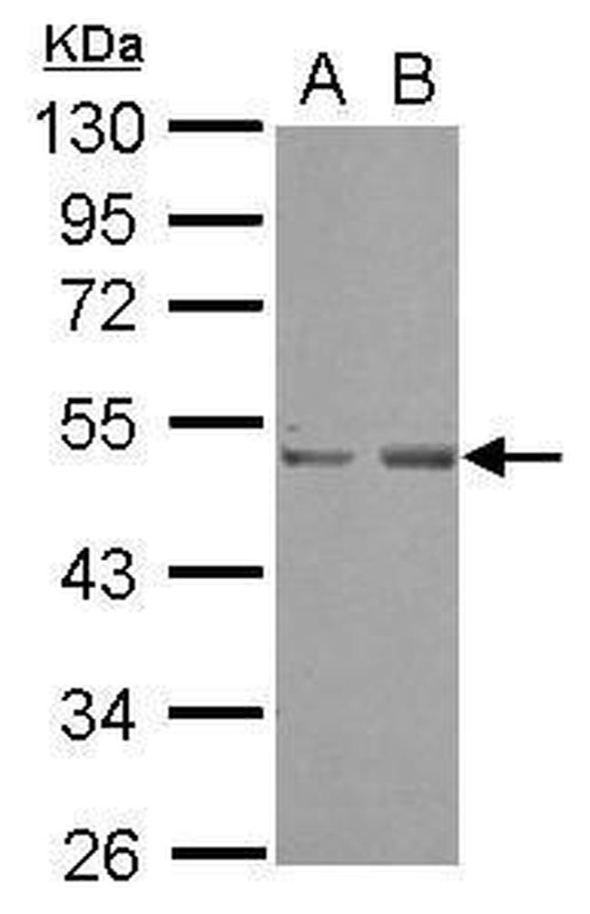 SETD7 Antibody in Western Blot (WB)