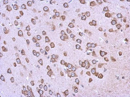 BAG2 Antibody in Immunohistochemistry (Paraffin) (IHC (P))