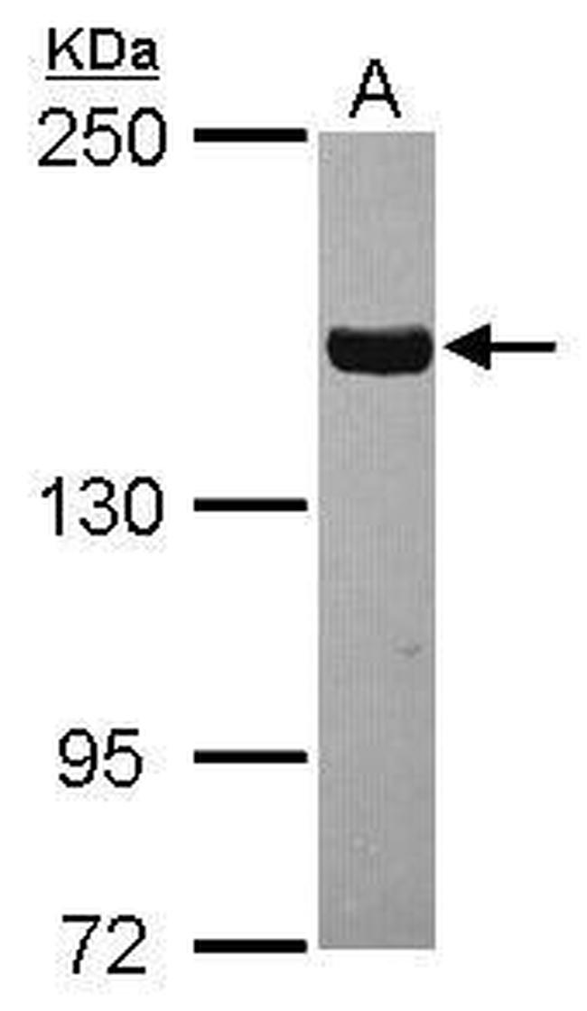 Tankyrase Antibody in Western Blot (WB)