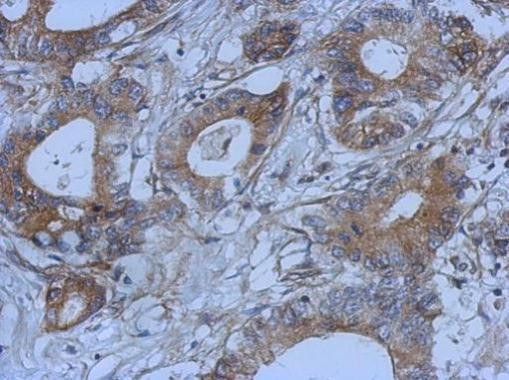 G72 Antibody in Immunohistochemistry (Paraffin) (IHC (P))