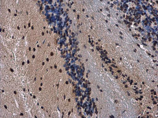 HP1 gamma Antibody in Immunohistochemistry (Paraffin) (IHC (P))