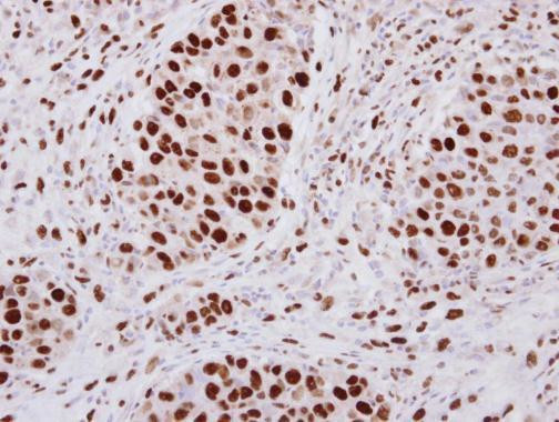 hnRNP A2B1 Antibody in Immunohistochemistry (Paraffin) (IHC (P))