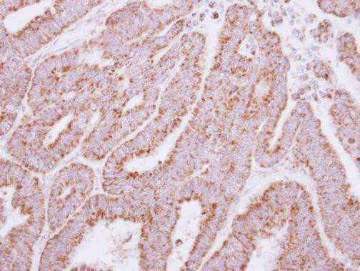 HAGH Antibody in Immunohistochemistry (Paraffin) (IHC (P))