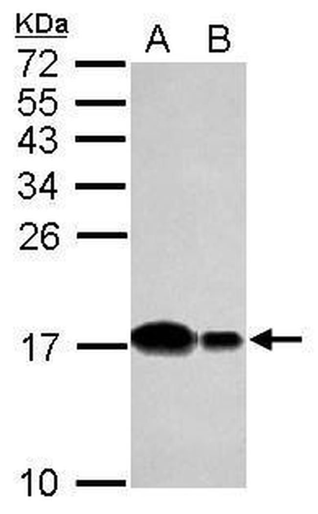 UBE2D2 Antibody in Western Blot (WB)