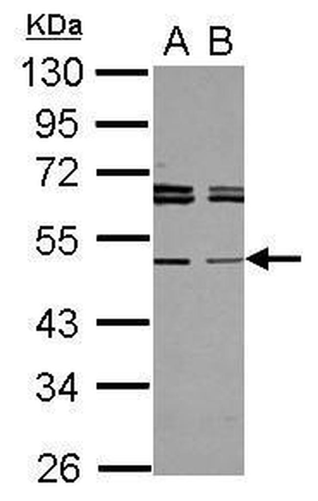 TAPBPL Antibody in Western Blot (WB)