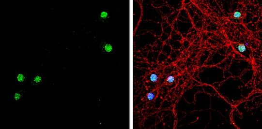 TBR1 Antibody in Immunocytochemistry (ICC/IF)