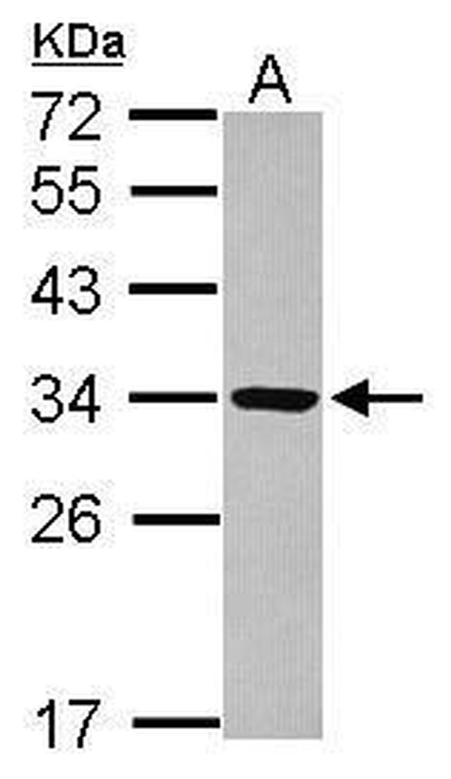 RRP4 Antibody in Western Blot (WB)