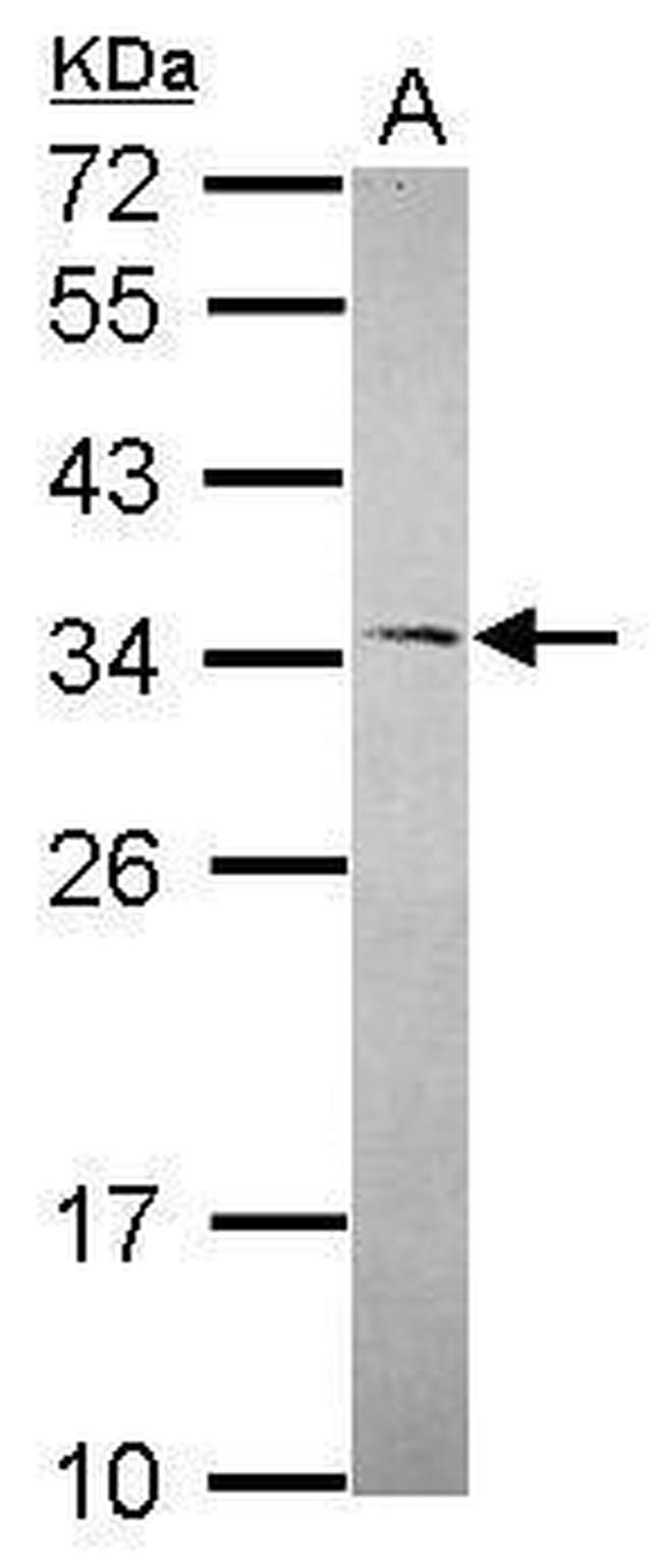 RNaseH1 Antibody in Western Blot (WB)