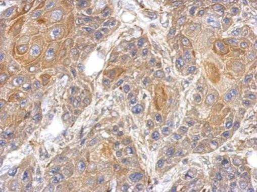 RAPGEFL1 Antibody in Immunohistochemistry (Paraffin) (IHC (P))