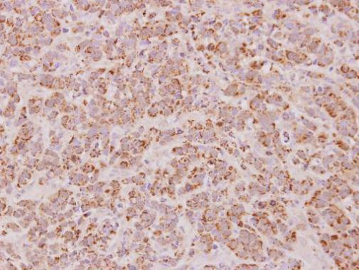 PSMB7 Antibody in Immunohistochemistry (Paraffin) (IHC (P))