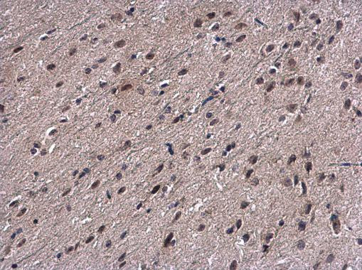 PSMB7 Antibody in Immunohistochemistry (Paraffin) (IHC (P))