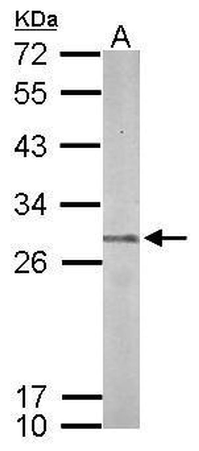 PSMB7 Antibody in Western Blot (WB)