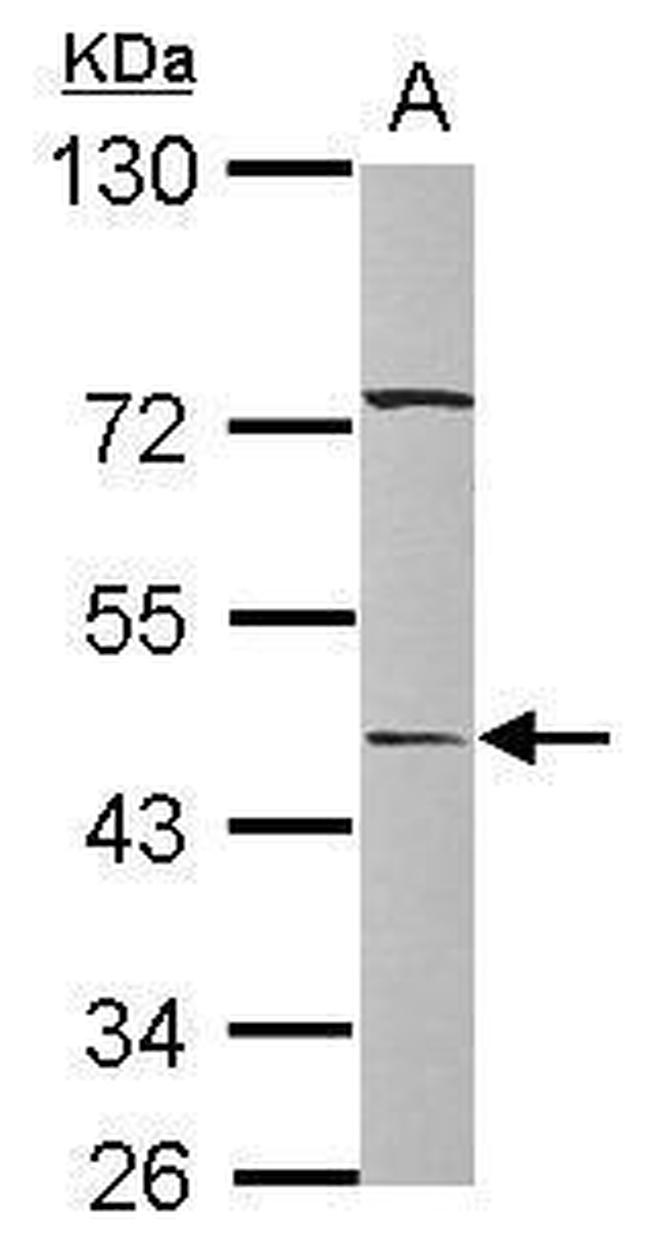 SERPINA12 Antibody in Western Blot (WB)