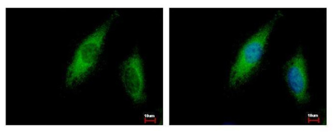 ABCE1 Antibody in Immunocytochemistry (ICC/IF)