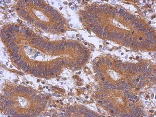 ABCE1 Antibody in Immunohistochemistry (Paraffin) (IHC (P))