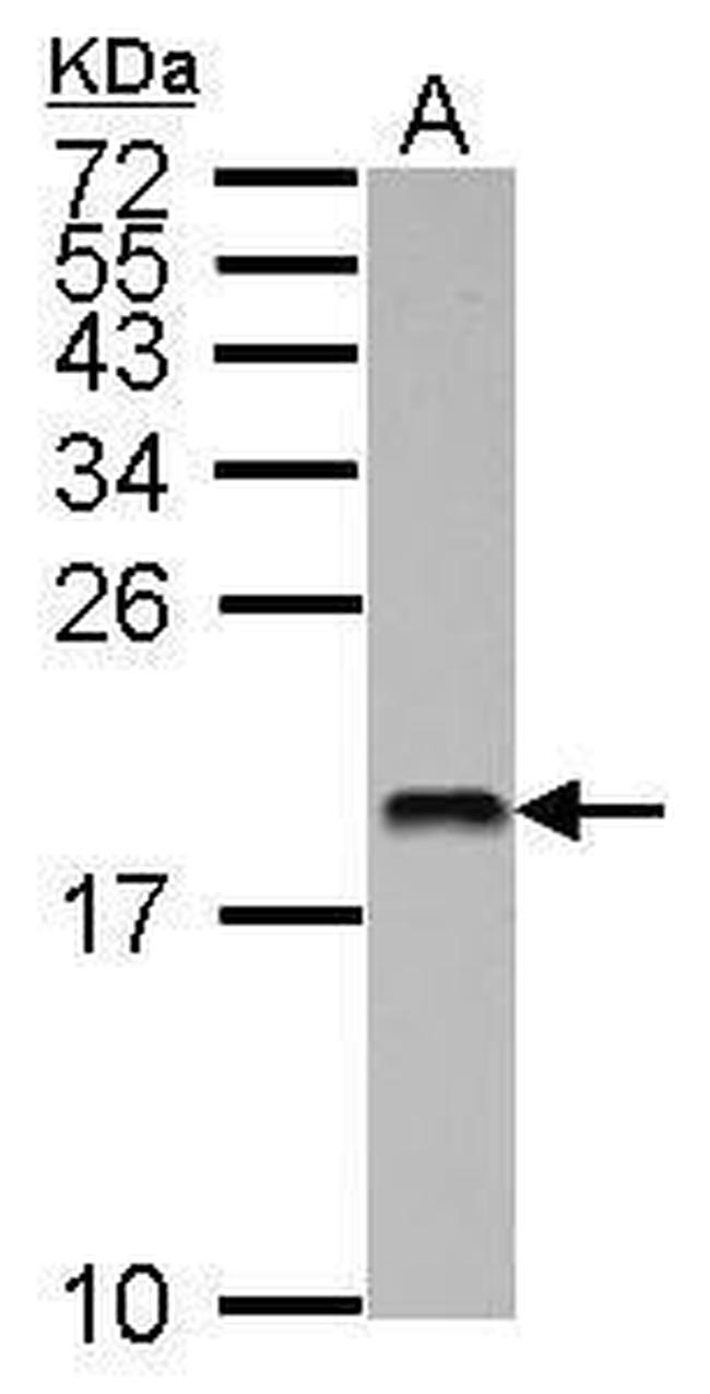 UBE2V2 Antibody in Western Blot (WB)