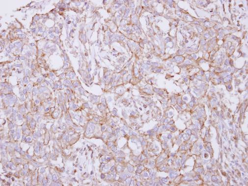 TXNDC9 Antibody in Immunohistochemistry (Paraffin) (IHC (P))