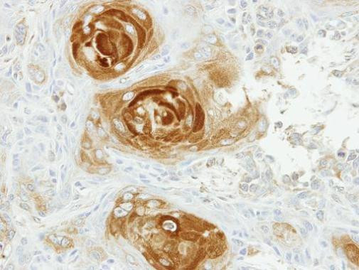 PAT1 Antibody in Immunohistochemistry (Paraffin) (IHC (P))