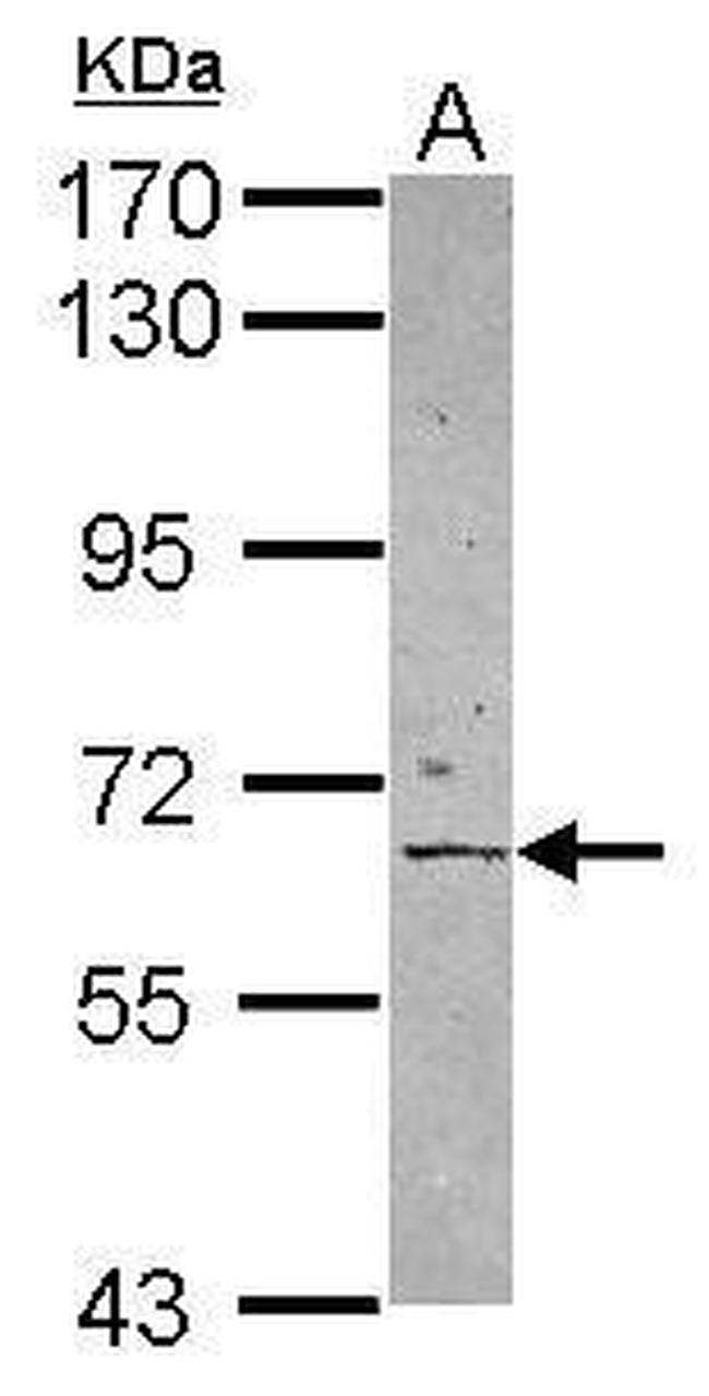 PAT1 Antibody in Western Blot (WB)