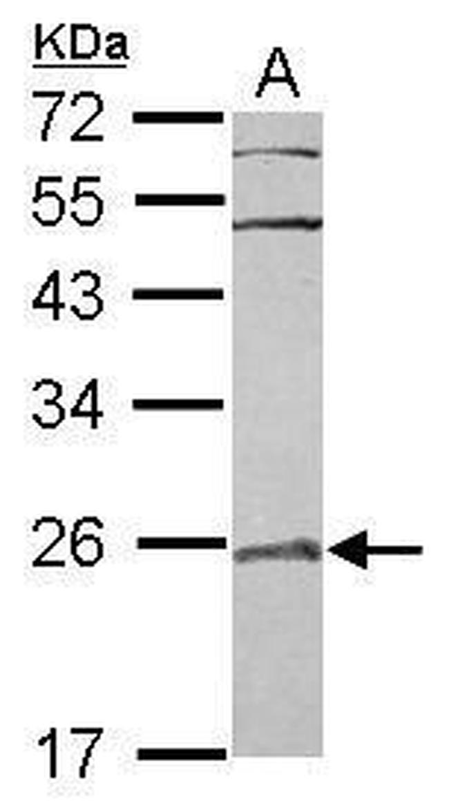 RAB29 Antibody in Western Blot (WB)