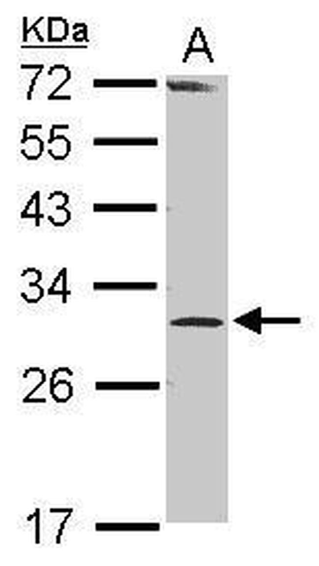 RPP30 Antibody in Western Blot (WB)