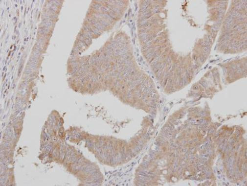 ADAMTSL1 Antibody in Immunohistochemistry (Paraffin) (IHC (P))