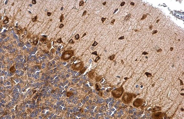 MSI2 Antibody in Immunohistochemistry (Paraffin) (IHC (P))