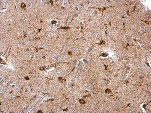 MSI2 Antibody in Immunohistochemistry (Paraffin) (IHC (P))