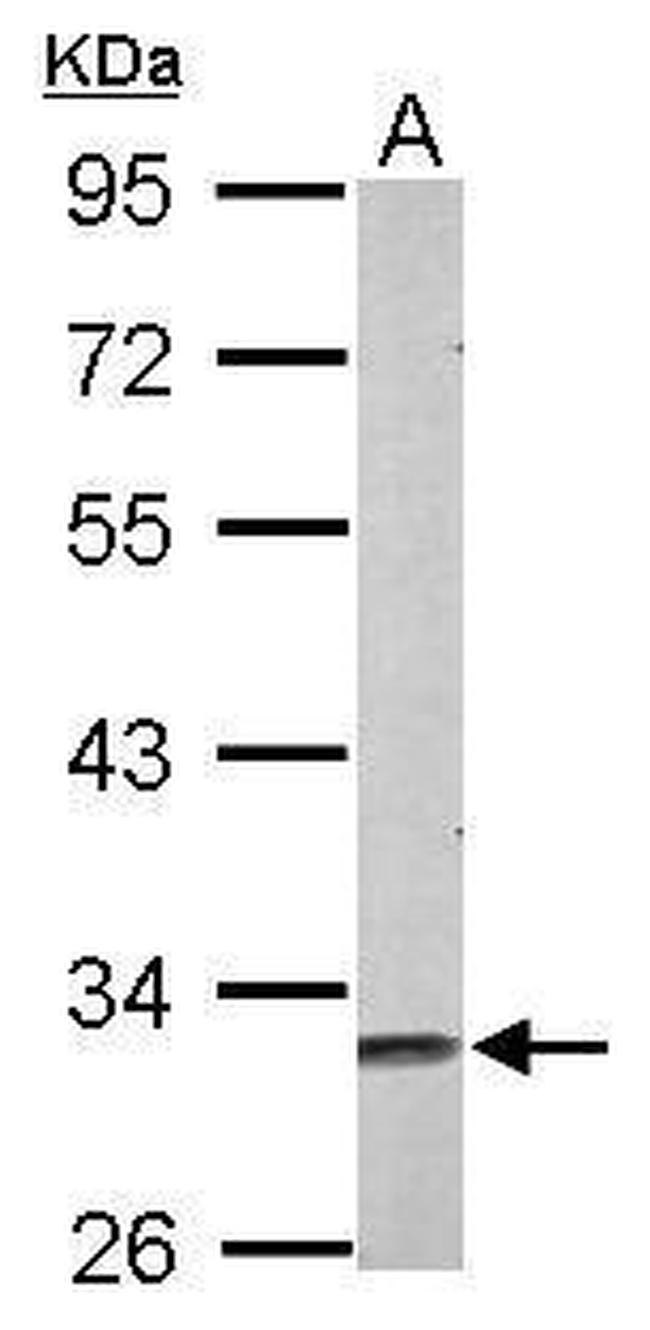 MSI2 Antibody in Western Blot (WB)