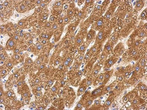 SIRT5 Antibody in Immunohistochemistry (Paraffin) (IHC (P))