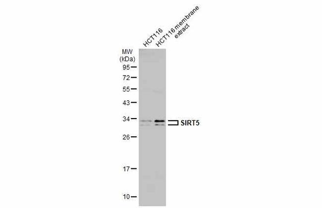 SIRT5 Antibody in Western Blot (WB)