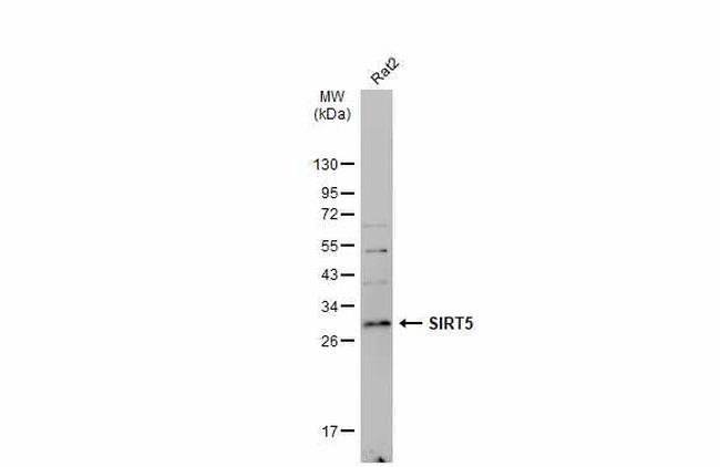 SIRT5 Antibody in Western Blot (WB)