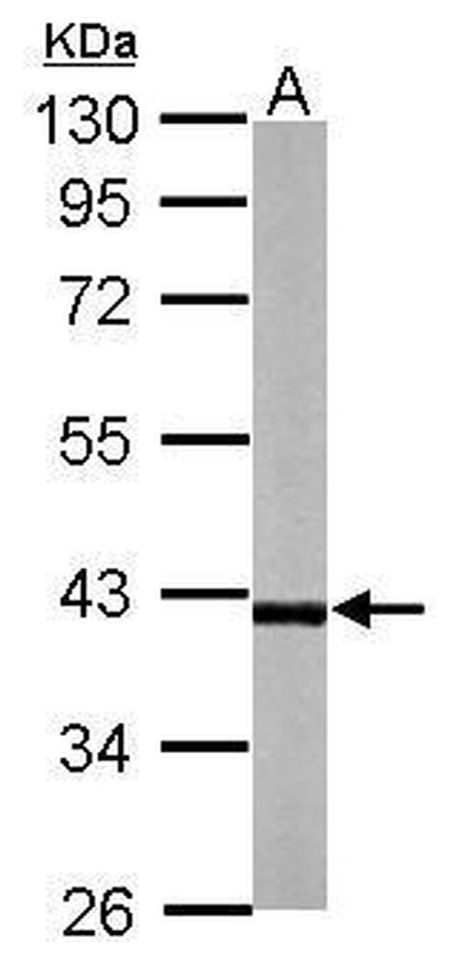 RFFL Antibody in Western Blot (WB)