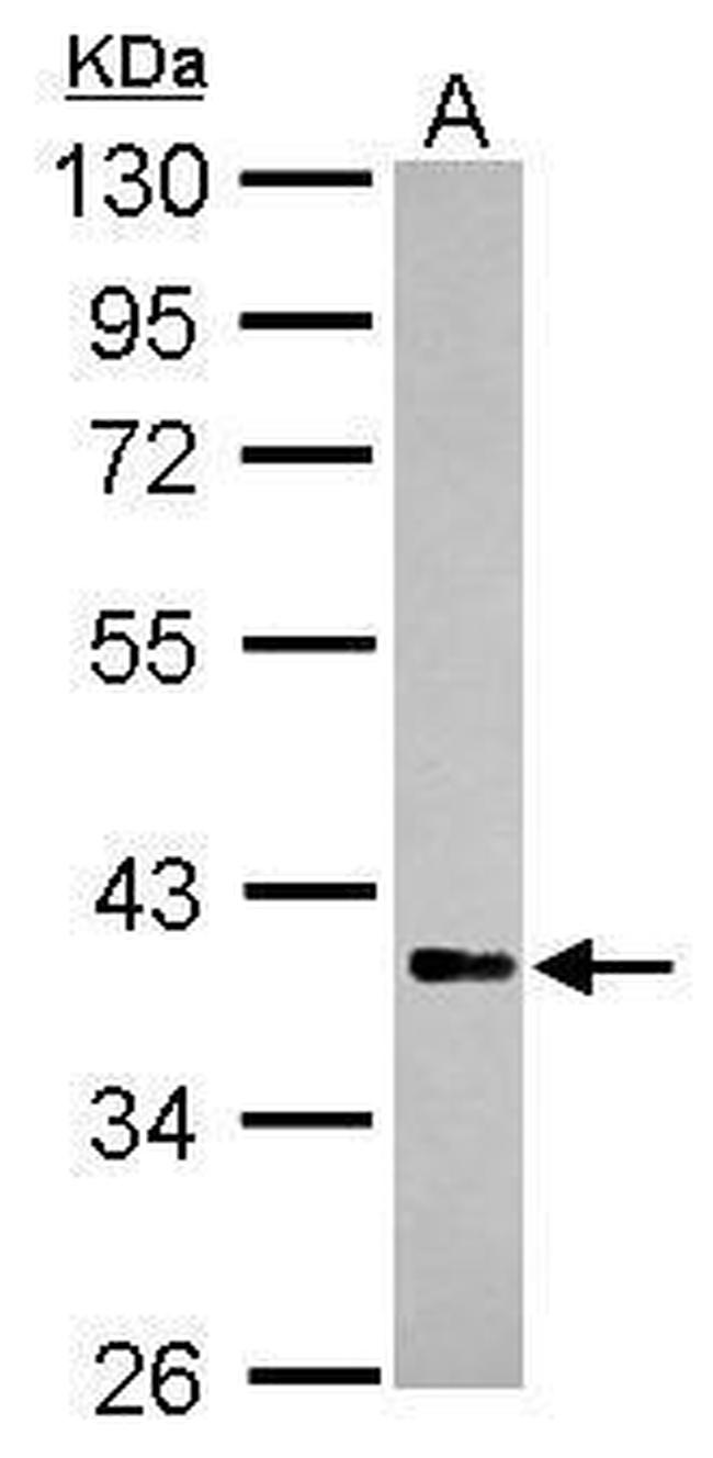 RFFL Antibody in Western Blot (WB)