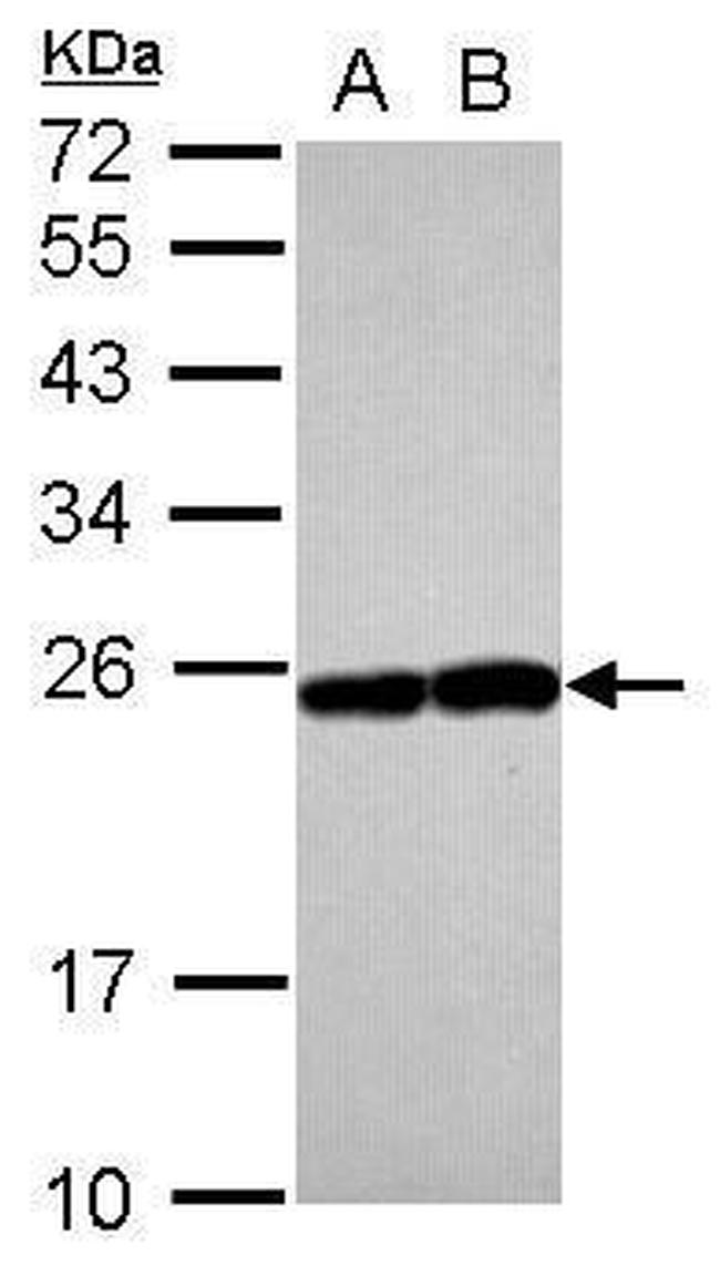 RAB17 Antibody in Western Blot (WB)