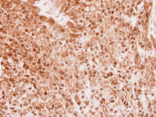 SERGEF Antibody in Immunohistochemistry (Paraffin) (IHC (P))