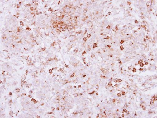 SPRED2 Antibody in Immunohistochemistry (Paraffin) (IHC (P))