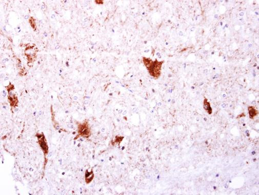 EGFLAM Antibody in Immunohistochemistry (Paraffin) (IHC (P))