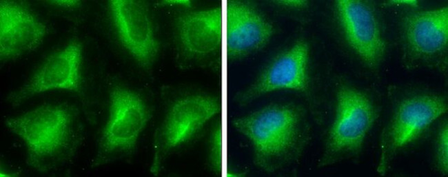 GPD1 Antibody in Immunocytochemistry (ICC/IF)