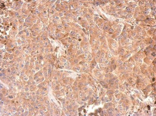 GPD1 Antibody in Immunohistochemistry (Paraffin) (IHC (P))