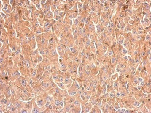 GPD1 Antibody in Immunohistochemistry (Paraffin) (IHC (P))