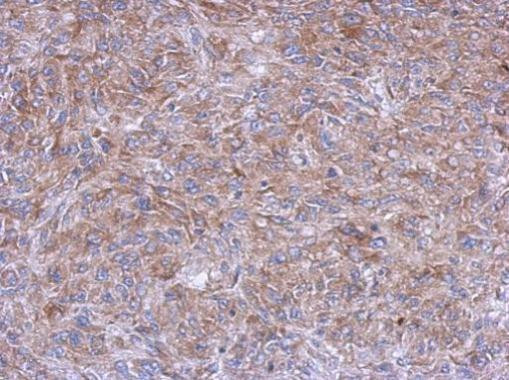 GPD1 Antibody in Immunohistochemistry (Paraffin) (IHC (P))