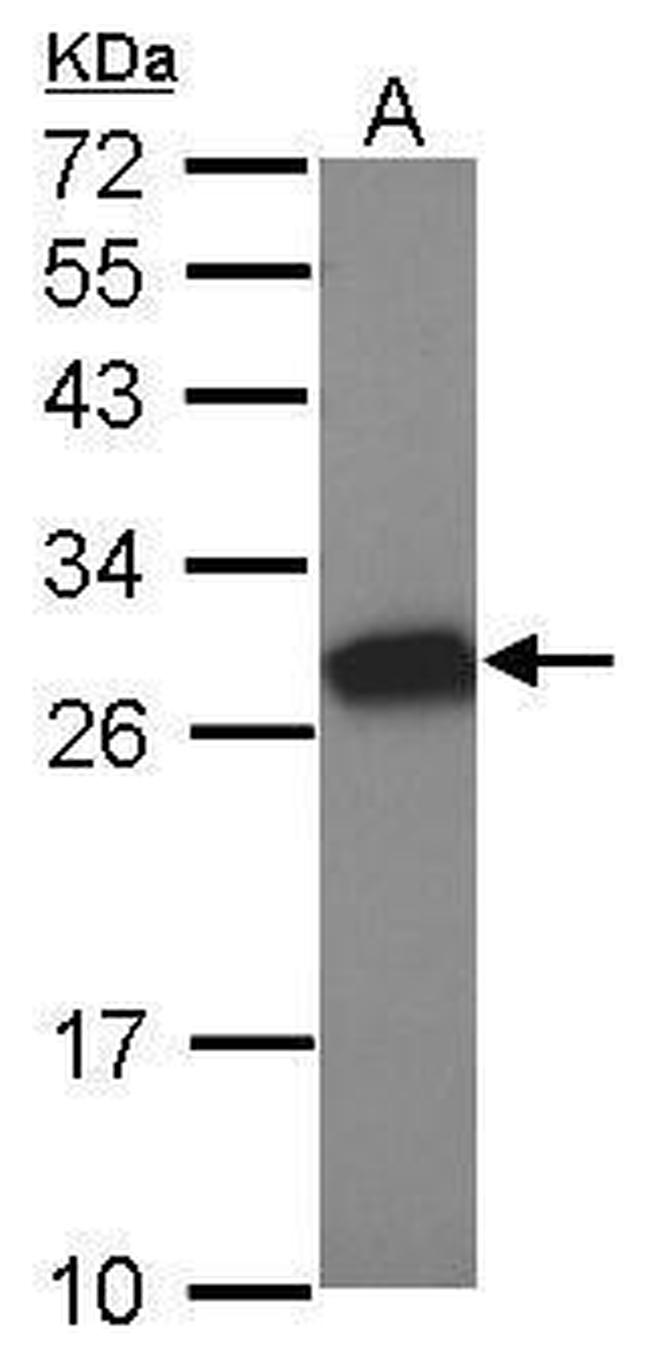 Tesmin Antibody in Western Blot (WB)