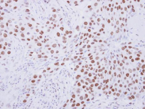 SENP3 Antibody in Immunohistochemistry (Paraffin) (IHC (P))