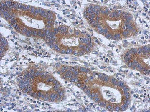 TRIM15 Antibody in Immunohistochemistry (Paraffin) (IHC (P))